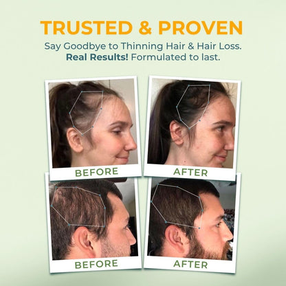 VITAL NUTRITIVE Biotin Hair Growth – Hair, Skin & Nails